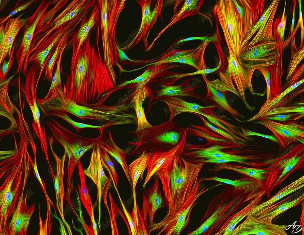 arkajit_de's tweet photo. Real (Left) vs Illustrated (Right) fluorescence microscopic view of human lung fibroblast cell 
Real Image credit: https://t.co/6WlS9NYZcI

Illustrated by @Photoshop
#FluorescenceFriday #sciart https://t.co/v3oaNq3V07