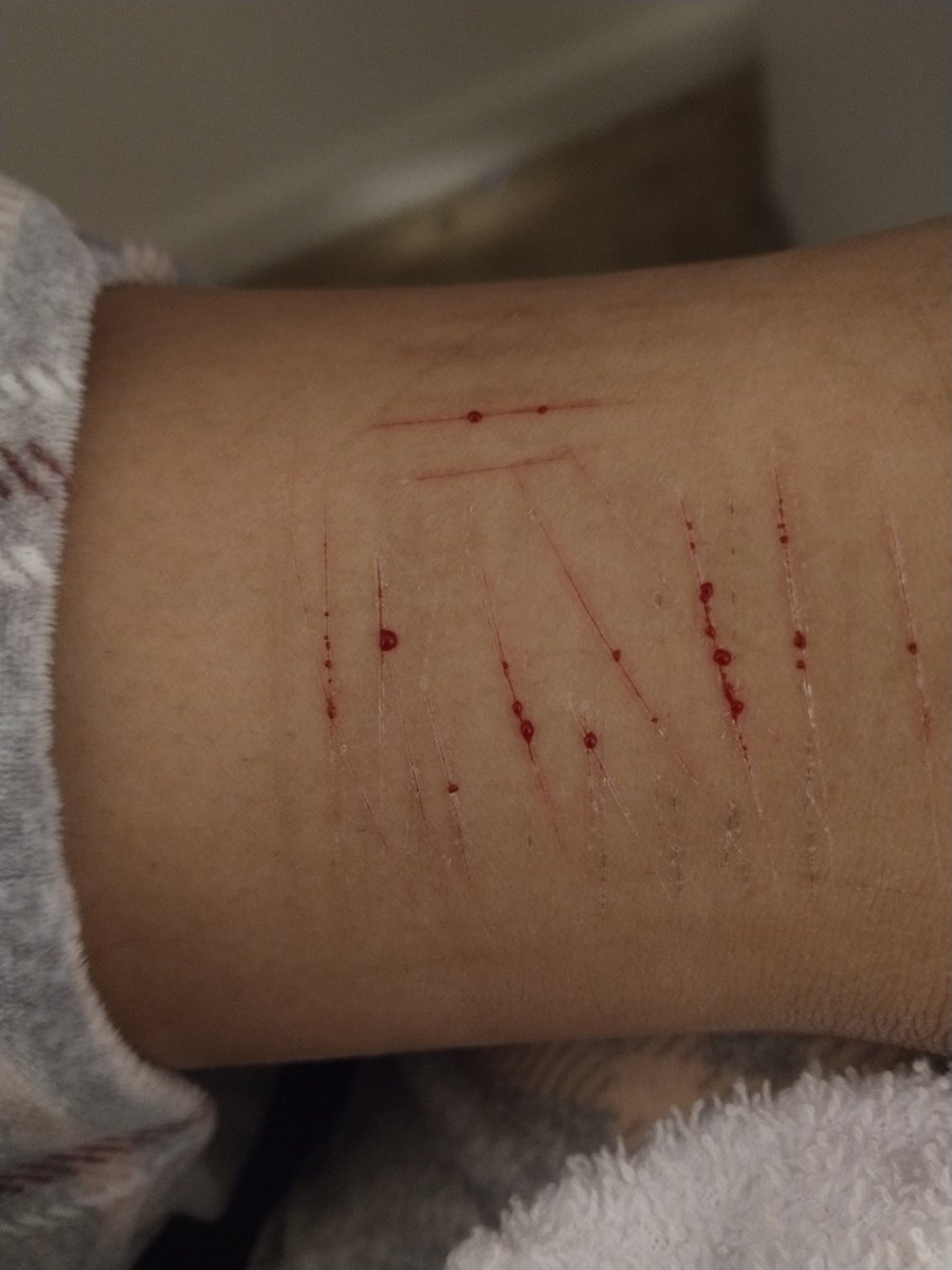 cuts4adri's tweet photo. razor isn't sharp anymore 😐 but wtv,, someone give me some suggestions bc i need TO MAKE MY CUTS BLEED MORE https://t.co/M1iWoswlOe