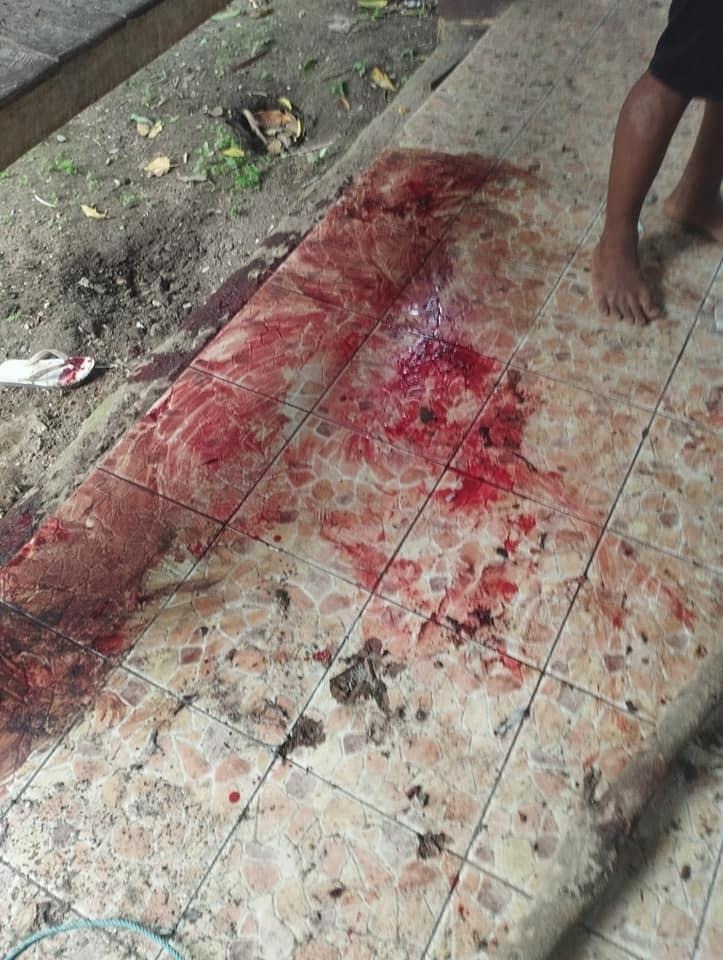 HURFOM's tweet photo. TW/GRAPHIC CONTENT

The junta's shoot-to-kill strategy in Kawkareik killed at least eight and injured more than 25, HURFOM confirmed. Women, children, and a Buddhist Monk were included in the casualties. https://t.co/sDfVjdeTpb