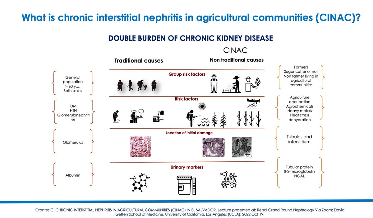 @UclaNephrology @UCLAHealth #RenalGrandsRound| What’s chronic interstitial nephritis in agricultural communities #CINAC❓