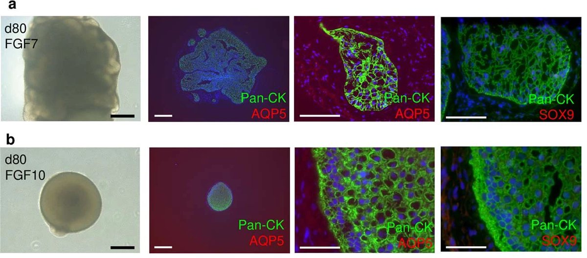 🚨 #COVID research alert! Scientists at Showa University 🎌, generated human-induced salivary glands from #hiPSCs which may be a promising model for investigating the role of salivary glands as a SARS-CoV-2 reservoir. Published in @NatureCellBio: 👉 go.nature.com/3VFfnig