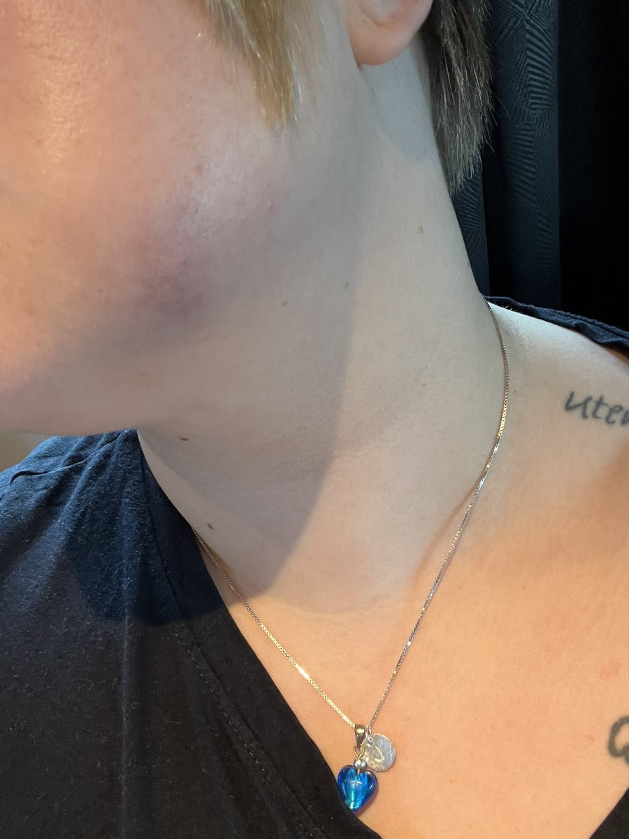 Ortostatisme's tweet photo. Dagens gode gjerning; Frisøren som så hevelsen og blåmerket på kjeven min, tok meg med på bakrommet og spurte om jeg trenger hjelp til å komme meg i sikkerhet. Jeg har bare fjerna ei visdomstann, men det er sjukt fint å vite at det finnes folk som ikke er redd for å spørre! https://t.co/GgEBhj661T