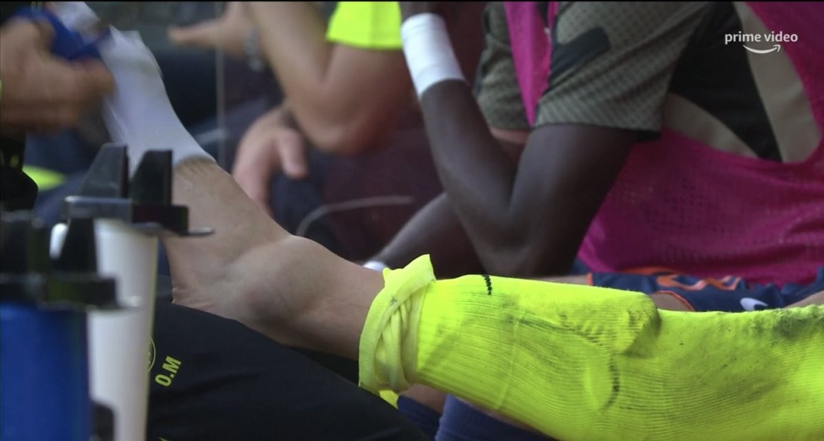 Footballogue's tweet photo. La blessure d’Omlin, gardien montpelliérain, contraint de céder sa place cet après-midi face à Lyon. 🤕

(@PVSportFR) https://t.co/5amUV9UYug