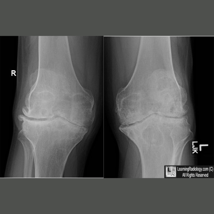 Learning Radiology On Twitter https t co zmoFgCADt9 Case Of The Week 1 035 Is A 37 Year old 