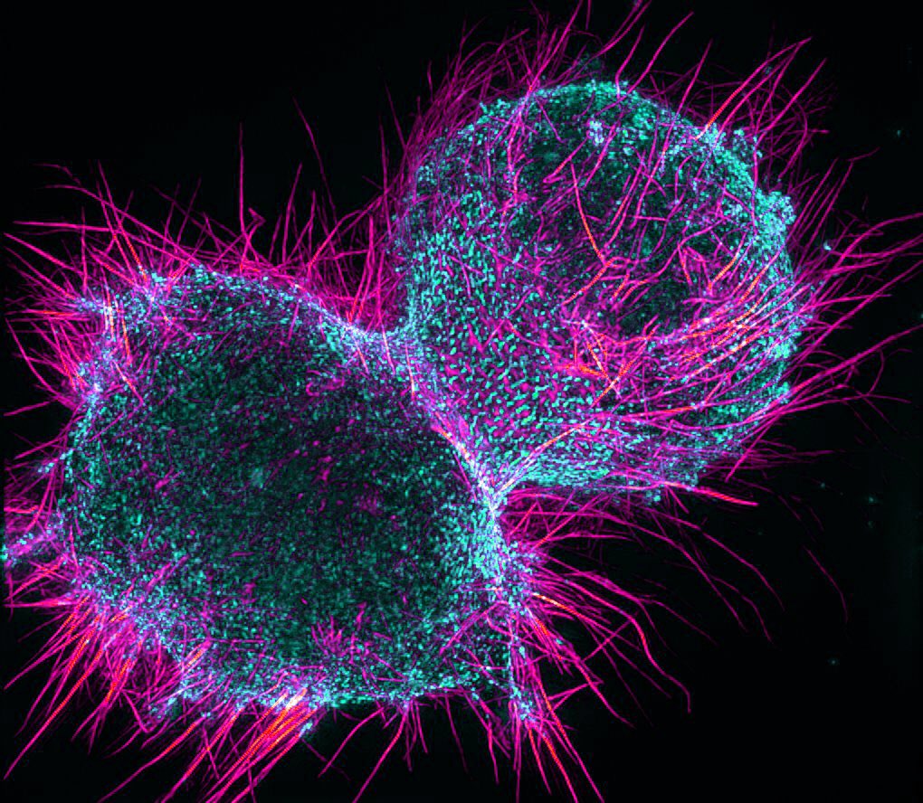 A dividing cell photographed through a microscope. #CellBiology