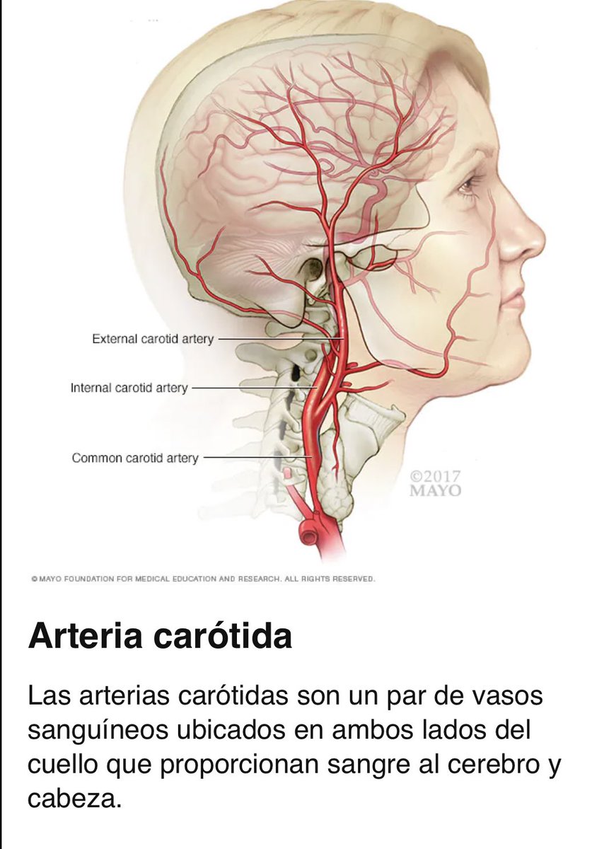 EstebanOrtizMD's tweet photo. El cerebro utiliza más del 15-20% del total de la sangre de tu cuerpo por minuto ! Si tienes placas de aterosclerosis en una arteria carótida (vía x la cual llega la sangre al cerebro) sufres riesgo alto de sufrir un evento cerebro vascular isquémico (infarto cerebral) #hiloFlash https://t.co/XJfZb0fES8