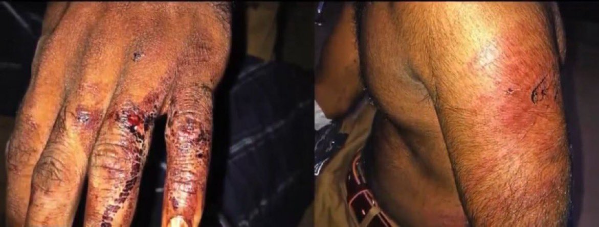 SouthExpress_'s tweet photo. Shocking: In Kerala, a serving Indian army officer &amp; brother was brutally beaten, asked to drink urine by SHO &amp; four policemen after framing them in fake drug case. Victims disclosed the policemen broke army soldiers fingers saying that he won’t be able to pull the trigger again. https://t.co/R9jumGdtL7