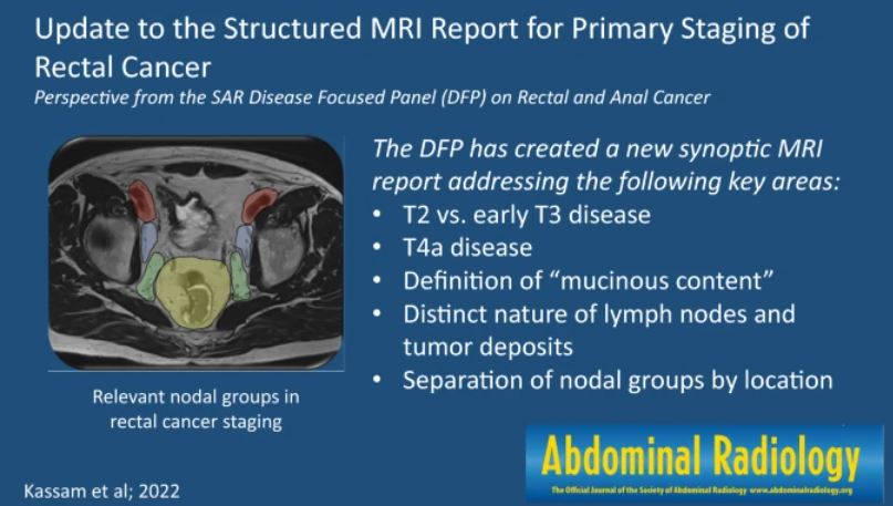Graphic abstract published July 26,2022 #abdradJ #radiology #imaging Update to the structured MRI report for primary staging of rectal cancer. Perspective from the SAR Disease Focused Panel on Rectal and Anal Cancer. Zahra Kassam et al ow.ly/wOQg50L9MtI
