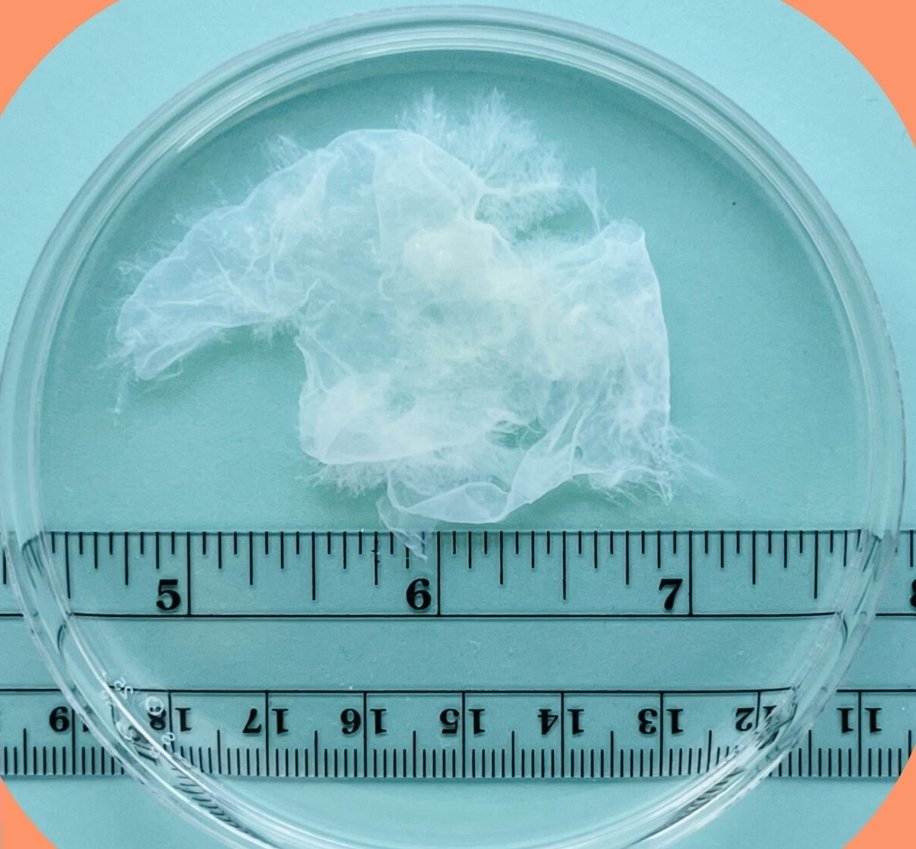 OprimidaRobot's tweet image. Así se ve el cerebro de los &quot;Pro-Vida&quot;... no lo digo yo, lo dice @guardian