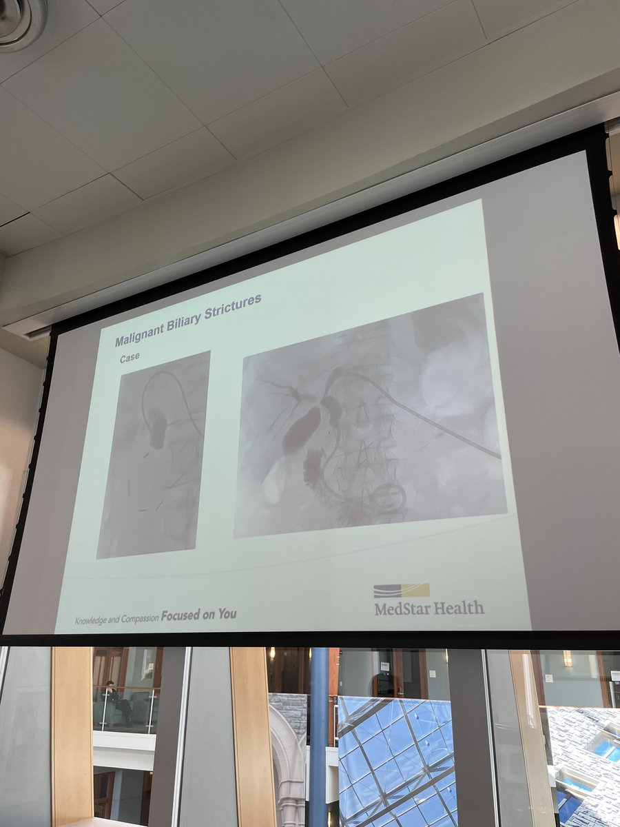 Medstar Georgetown IR (@georgetown_ir) on Twitter photo An up-and-coming cholangioscopy legend, thank you <a href="/johnsmirnMD/">John Smirniotopoulos</a> for teaching everyone about how IR can help patients with biliary disease and cholelithiasis!
<a href="/hpbjournal/">@HPBjournal</a> <a href="/hpb/">H</a> <a href="/EmilyWinslow4/">Emily Winslow</a> <a href="/WBrowneVIR/">William F Browne MD</a> <a href="/MedStarWHC/">MedStar Washington</a> <a href="/dmarchalik/">Daniel Marchalik</a> <a href="/medravi/">Ravi Srinivasa</a> An up-and-coming cholangioscopy legend, thank you <a href="/johnsmirnMD/">John Smirniotopoulos</a> for teaching everyone about how IR can help patients with biliary disease and cholelithiasis!
<a href="/hpbjournal/">@HPBjournal</a> <a href="/hpb/">H</a> <a href="/EmilyWinslow4/">Emily Winslow</a> <a href="/WBrowneVIR/">William F Browne MD</a> <a href="/MedStarWHC/">MedStar Washington</a> <a href="/dmarchalik/">Daniel Marchalik</a> <a href="/medravi/">Ravi Srinivasa</a>