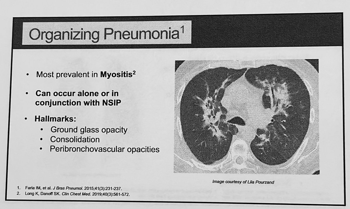 vksandhumd's tweet photo. Dr Volkmann back for more #ILD in #CTD. See patterns of ILD typically seen in CTD.
👉🏽 PFTs- ⬇️DLCO, FVC, TLC
👉🏽 get extensive autoAb work up (ANA, SSA, SSB, scleroderma and myositis panel, RF, CCP
👉🏽6MWT w desat
#Rheumatology #RheumTwitter #ILD @AWIRGROUP @atscommunity https://t.co/oE5oDeyigy