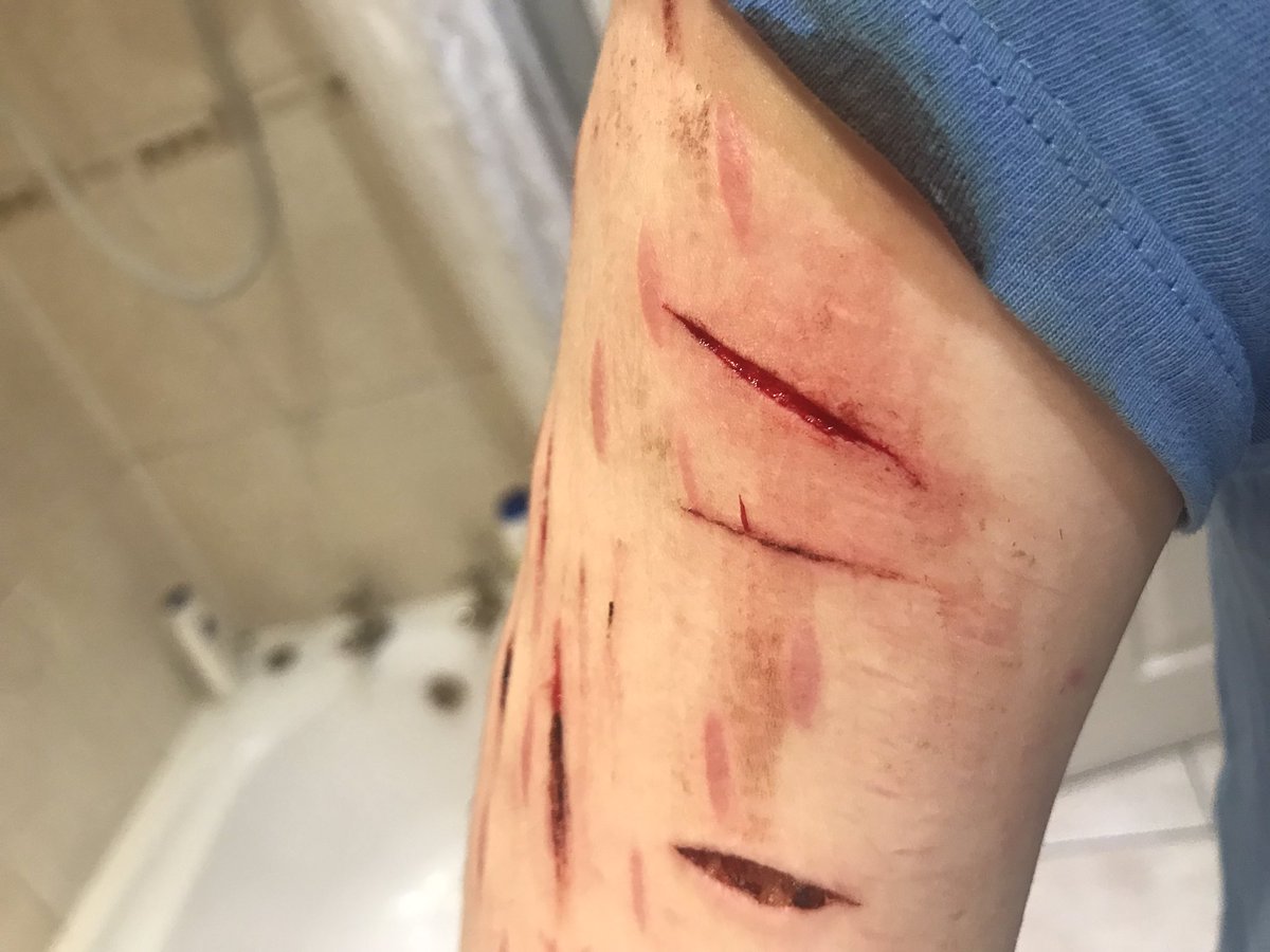 c3l3ry0's tweet photo. tw//sh
i hate baby cuts https://t.co/urMaB0PBXR