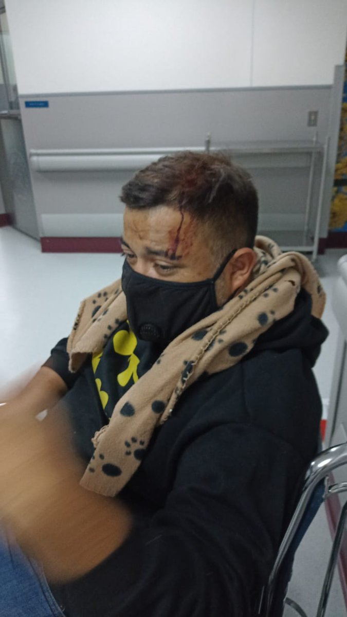 ArthuroBN's tweet photo. El destino hizo que ayer tuviera un accidente y eso hará que no pueda estar en el estadio hoy... Pero este donde este siempre hasta el final @csherediano1921 https://t.co/e1W6k8UIZG