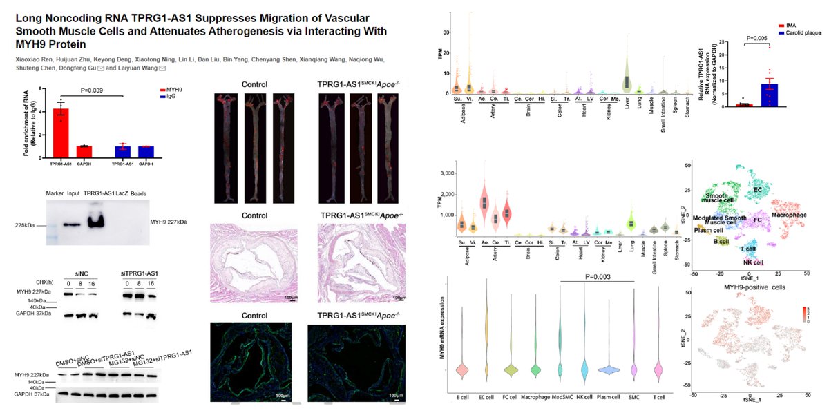 HaoYin20's tweet image. #LongNoncodingRNA TPRG1-AS1 ⏬#SmoothMuscleCell Migration (Not proliferation/contractile phenotype) via⏫Proteasomal degradation of MYH9 protein

Protective role against🐭Neointima &amp;amp; #Atherosclerosis

Dr Dongfeng Gu &amp;amp; Laiyuan Wang lab @atvbahajournals 2022
ahajournals.org/doi/10.1161/AT…