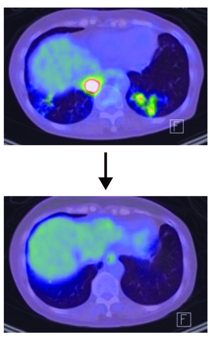 Science Translational Medicine tweet media