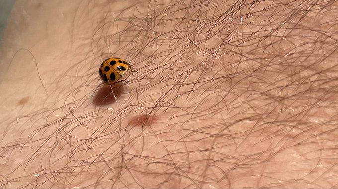 Update: now getting eaten alive by asian ladybugs. These beetles be thirsty AF&hellip; https://t.co/er008yn<a href="/tag/sweatpants"class="tags"><span>#sweatpants</span></a><a href="/tag/dilf"class="tags"><span>#dilf</span></a><a href="/tag/fwb"class="tags"><span>#fwb</span></a>