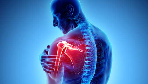 AJA_Cortes's tweet photo. AJACs TOP 10 TIPS FOR SHOULDER HEALTH THREAD: 

Shoulder problems are common in both men &amp; women, they can come from gym &amp; sport injuries, to playing with your kids

but the shoulders are highly TRAINABLE

Read this for healthier, stronger, injury resistant shoulders https://t.co/GZMVL3saLd