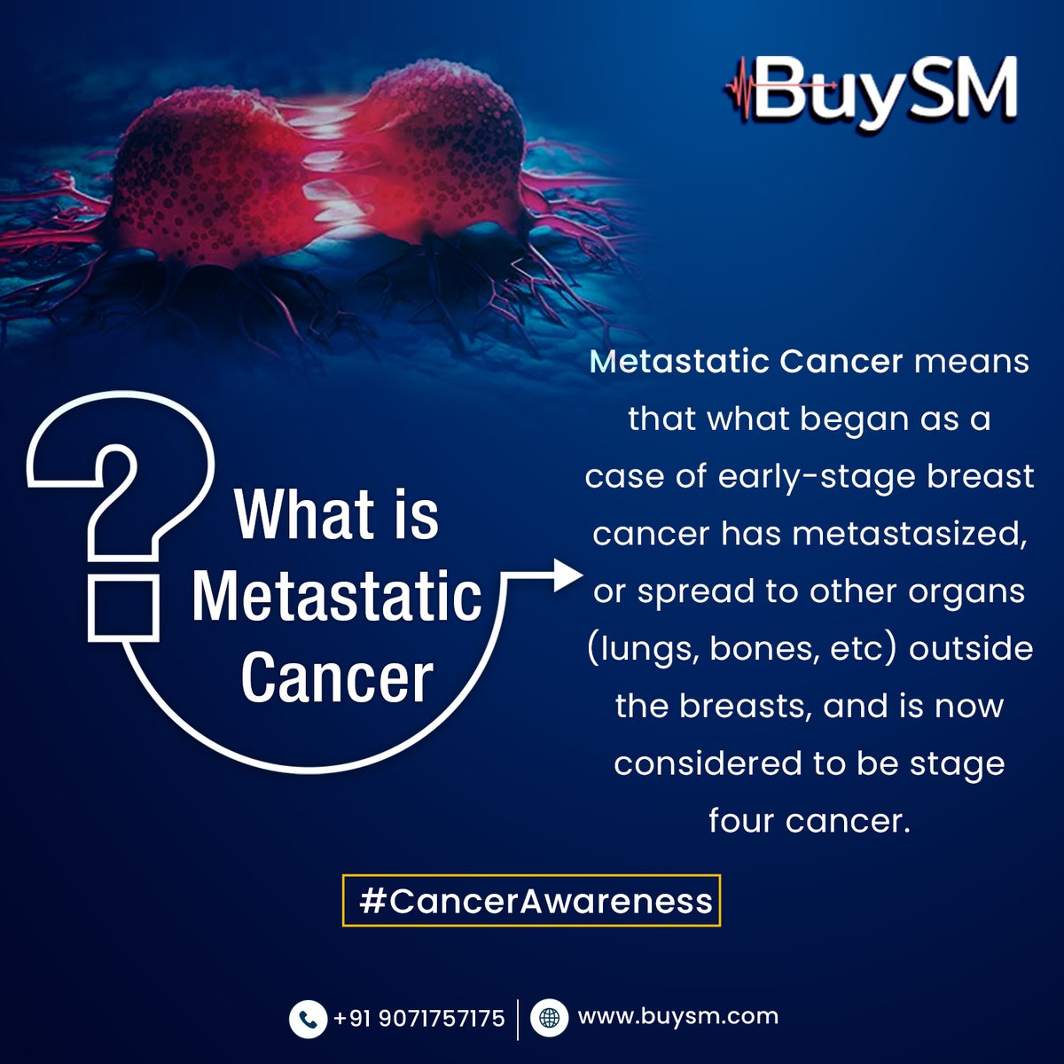 buysmofficials's tweet photo. Metastatic cancer affects the liver, lungs, brain, lymph nodes, and more. Those with metastatic breast cancer should be provided with the finest treatment options &amp; an understanding support system. 

Visit us on; https://t.co/WOVBmmM5uT 
#buysm #cancermedicines #trustedpharma https://t.co/Wfw5w8LxOA