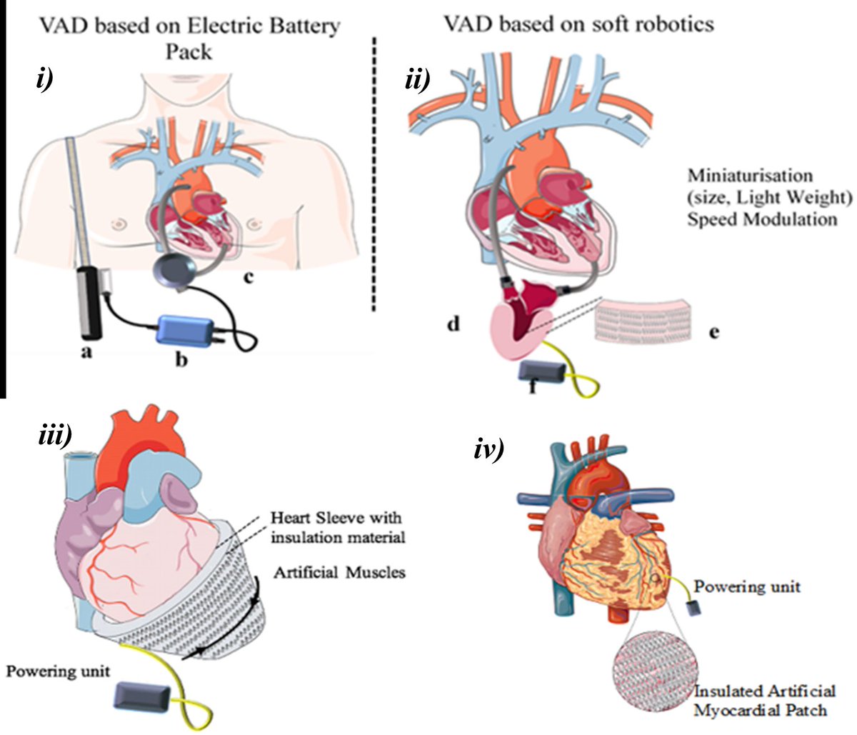 AArjomandiRad's tweet photo. Artificial Muscles and Soft Robotic Devices for Treatment of End-Stage Heart Failure 

Will a cardiac sleeve powered by soft robots be the future? 🫀

Out in Advanced Materials (IF:32) @AdvSciNews

@AWeymannMD @ruhparwar @JForoughi @GeoffreySpinks

Link: https://t.co/9Cl3aNphSA https://t.co/vTU2ZsunKU