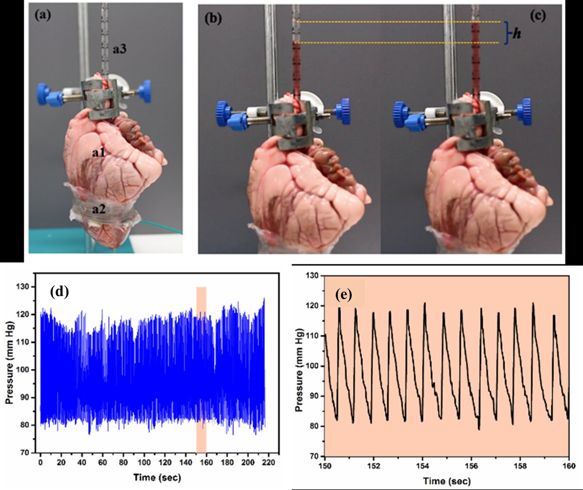 Artificial Muscles and Soft Robotic Devices for Treatment of End-Stage Heart Failure 

Will a cardiac sleeve powered by soft robots be the future? 🫀

Out in Advanced Materials (IF:32) @AdvSciNews

<a href="/AWeymannMD/">Ale𝕏ander Weymann</a> <a href="/ruhparwar/">Arjang Ruhparwar</a> <a href="/JForoughi/">Prof. Javad Foroughi</a> <a href="/GeoffreySpinks/">Prof Geoffrey Spinks</a>

Link: onlinelibrary.wiley.com/doi/10.1002/ad…