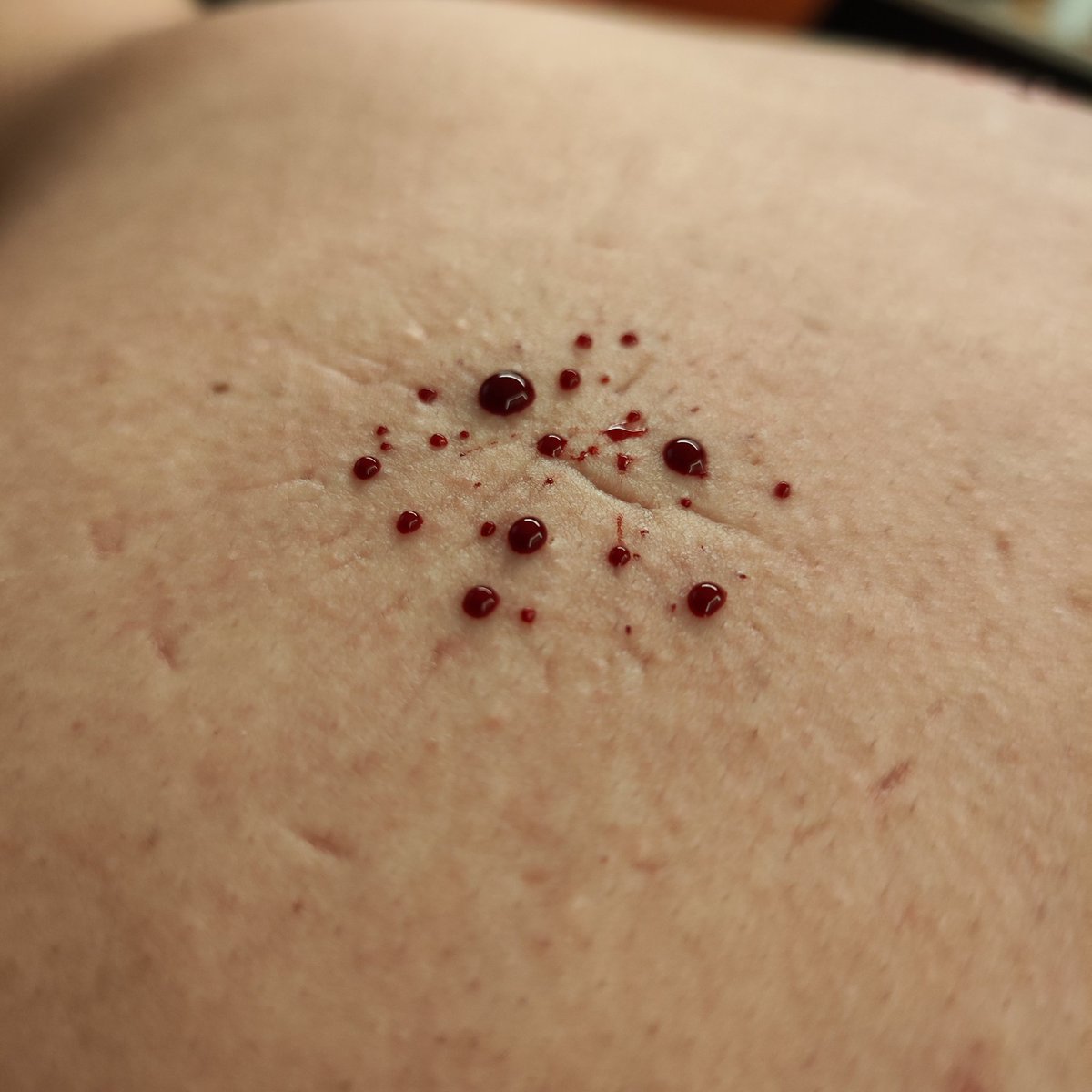 levideepdead's tweet photo. Mahjong, afterwards.
Thanks for trusting me to try this.
Bottom: @jnnn0w0 

#bdsm #hkbdsm #needle #needles #needleplay https://t.co/QG2ueeikEk