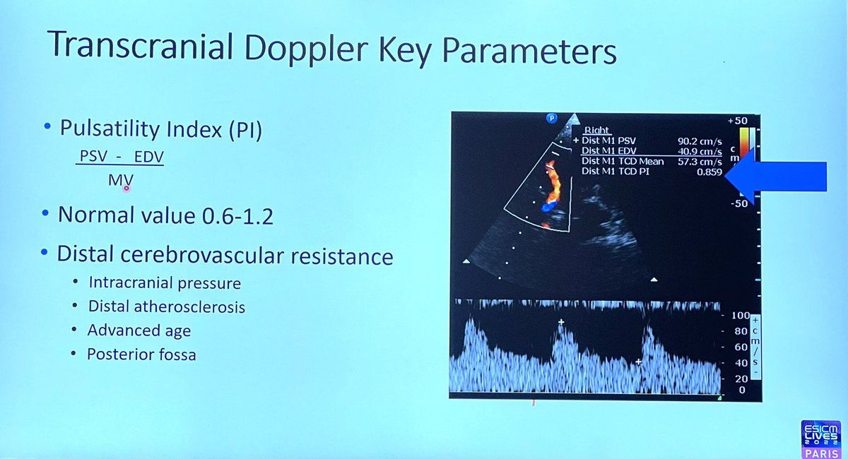 FOAMecmo's tweet photo. 🦋 Brain #ultrasound? NOT only in neurocritically ill but also in general #ICU ie after cardiac arrest or #sepsis
4 windows
🪟 temporal (major)
🪟 submandibular (carotid)
🪟 optical (linear probe for OSND)
🪟 suboccipital (vertebral/basilar)
#LIVES2022
@chiara_robba @aartisarwal https://t.co/XUz4u0ZOCC