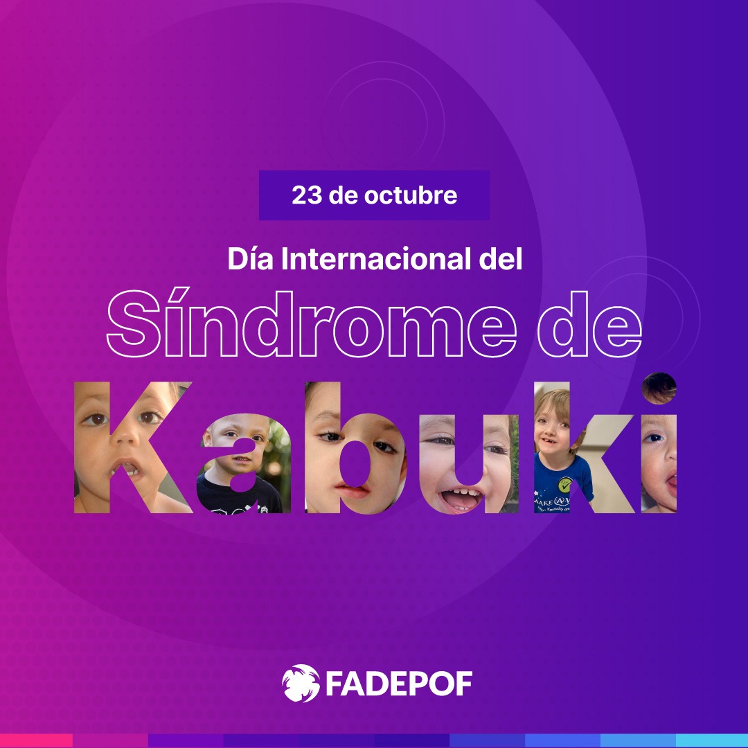 El Síndrome de Kabuki es una enfermedad poco frecuente caracterizada por múltiples anomalías congénitas, generadas por mutaciones espontáneas o por herencia autosómica dominante en el gen MLL2 y por deleciones en los genes KMT2D y KDM6A.
#DíaInternacionalDelSíndromeDeKabuki