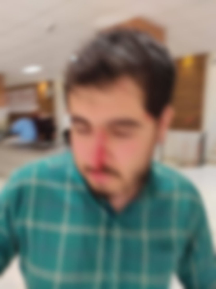 alifallahi21's tweet photo. وحشی‌های وقیح اینطوری به سلف حمله کردن و با «پرت کردن» شیشه‌های شکسته به سمت دانشجوها چند نفر رو زخمی کردن!
از فردا حتی تردد این «اراذل و اوباش» تو دانشگاه خطرناکه!
#یکشنبه_خونین_شریف
#دانشگاه_شریف https://t.co/jdyQgPuy0L
