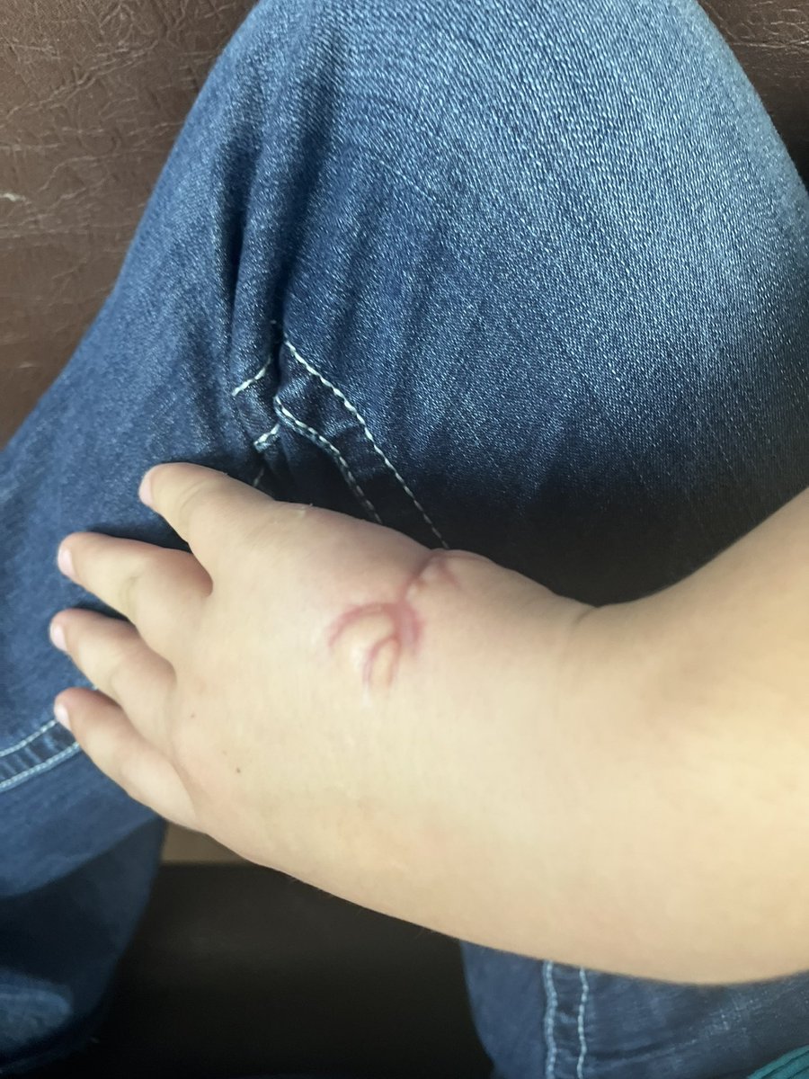 Elliepitcher42's tweet photo. After a traumatic hand injury in August I’ve been working on building strength and trying to get my groove back this fall. @OhioMojoMorgan @ncsa @NationalPID @Softball_Home @SoftballRio @Pitt_SB @J_Cottrill_ @mzerkleee @CoachKramer02 @boostsoftball @LegacyLegendsS1 @OhioBobcatSB https://t.co/wY2mAhLmXt