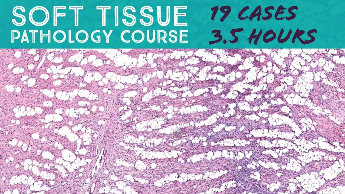 JMGardnerMD's tweet photo. Free Soft Tissue Pathology Course - 19 Cases in 3.5 Hours. Video: https://t.co/wjuK87vl9B (for the Oregon #Pathologists Association 2021 annual meeting). #BSTpath #pathology #pathTwitter #dermpath https://t.co/77GNCA86NC