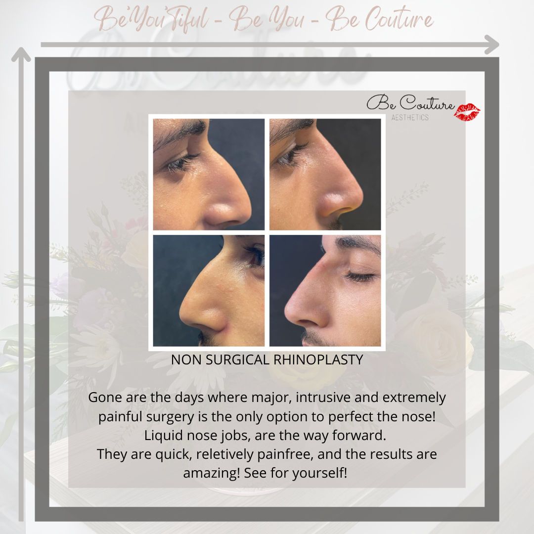 BeCoutureTrain's tweet photo. Non-surgical rhinoplasty. RRP £250 - Halloween special £200. Call to book a consultation. 

#nonsurgical https://t.co/basxUm7hWN
