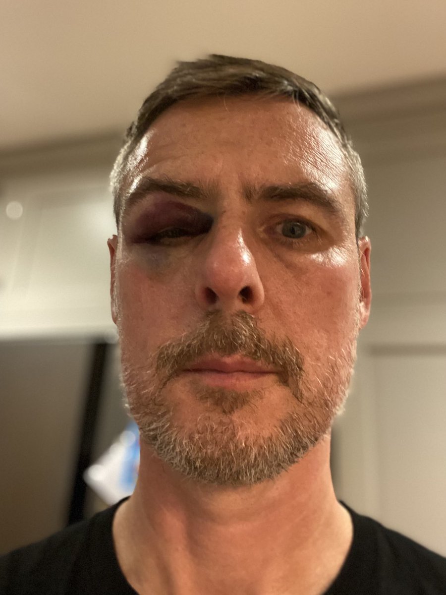 ‼️Warning ‼️ Coaching u11s rugby is DANGEROUS!! #10yearoldshavehardknees #rugby ⁦<a href="/RFU/">Rugby Football Union</a>⁩ ⁦<a href="/brianmoore666/">Brian Moore</a>⁩ ⁦<a href="/LeicesterTigers/">Leicester Tigers</a>⁩ ⁦<a href="/SystonRFC/">Syston RFC</a>⁩