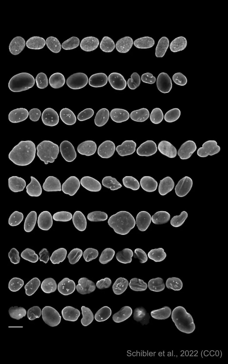 PreprintReview's tweet photo. Nuclear size and shape are diagnostic and prognostic traits for many human diseases including cancers. New #ReviewedPreprint from the @NCITomMisteli lab presents an #RNAi screen to identify epigenetic modulators that regulate nuclear morphology.

https://t.co/tIX0CiWSGH https://t.co/4uooNOmizp