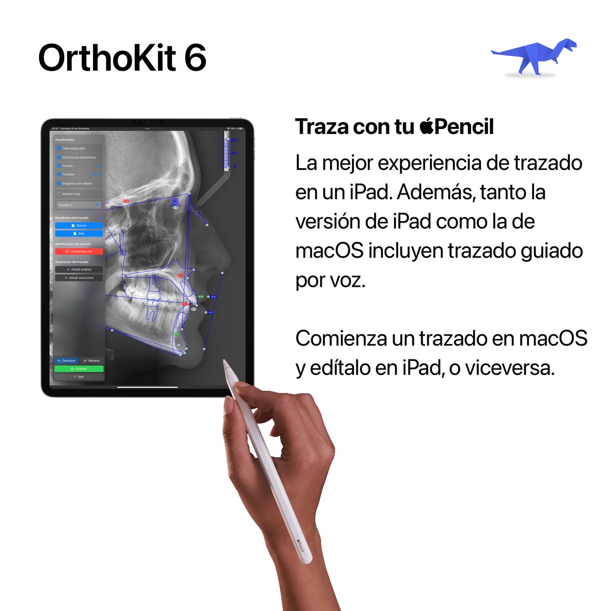 SwiftyAlbert's tweet image. Release Artwork #Xcode14 #macOSVentura #iPadOS16 #AppStore #MacAppStore #OrthoKit