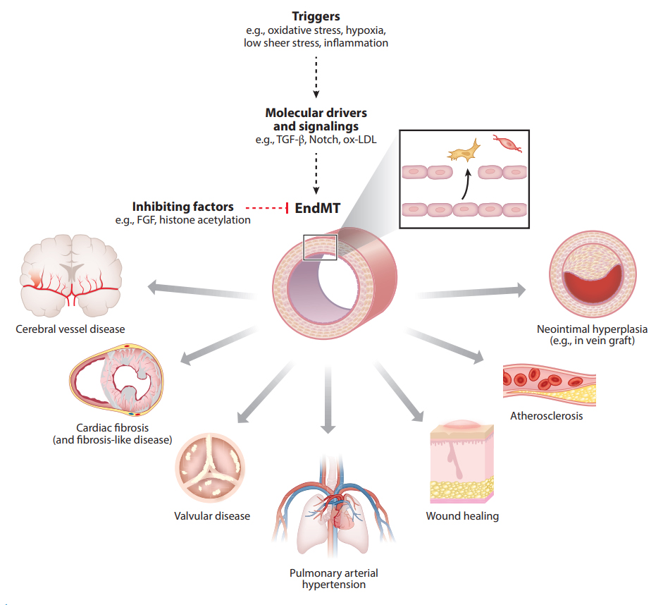 Congrats Yang @YoungHsu21 my stellar PhD student at @SinaiHeartBlood @MountSinaiHeart @IcahnMountSinai for his great review article on Endothelial to Mesenchymal Transition at Annual Rev Physiol pubmed.ncbi.nlm.nih.gov/36266259/ annualreviews.org/doi/10.1146/an…