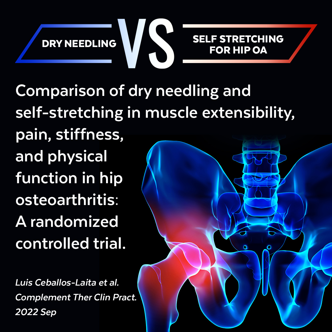 CPDHealthCourse's tweet image. Want to learn how to treat low back pain using the safest dry needling techniques? Join us at our next dry needling course. cpdhealthcourses.com.