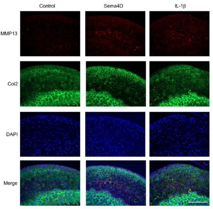 scisignal's tweet photo. New findings from a team at @osaka_univ_e identify the protein #Sema4D as a proinflammatory cytokine in joints—contributing to a broader understanding of the factors that drive joint degeneration in diseases such as arthritis. #Physiology https://t.co/PPaiTs36UO https://t.co/4gsU4Dqk9d