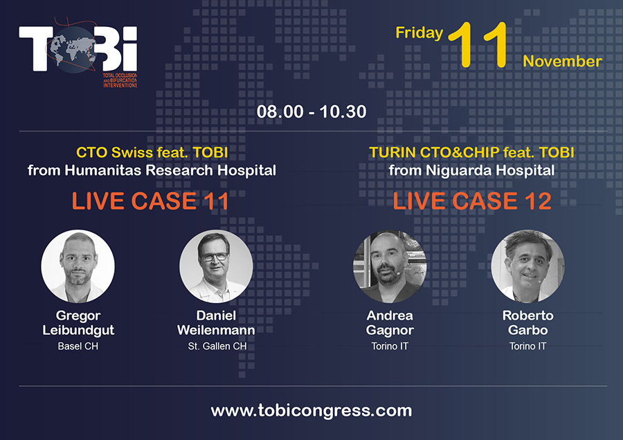 TOBI Total Occlusion Bifurcation Interventions (@tobicongress) on Twitter photo CTO session on Friday 11th November at #TOBI22
🇨🇭<a href="/swissCTO/">Gregor Leibundgut</a> <a href="/dantheman6559/">Daniel Weilenmann</a>
🇮🇹 <a href="/GagnorAndrea/">Andrea Gagnor</a> <a href="/RobertoGarbo1/">Roberto Garbo</a>
✏️tobicongress.com CTO session on Friday 11th November at #TOBI22
🇨🇭<a href="/swissCTO/">Gregor Leibundgut</a> <a href="/dantheman6559/">Daniel Weilenmann</a>
🇮🇹 <a href="/GagnorAndrea/">Andrea Gagnor</a> <a href="/RobertoGarbo1/">Roberto Garbo</a>
✏️tobicongress.com