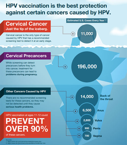 maddyfq's tweet photo. Over 42 million Americans currently have HPV and around 13 million become infected each year. 9 out of 10 HPV infections can go away by themselves, but some can last longer and even cause cancer. #MASC336 #HPVeducation 
@CDCgov -  https://t.co/lQDUjlVyb6 https://t.co/XoTvNSPeC3