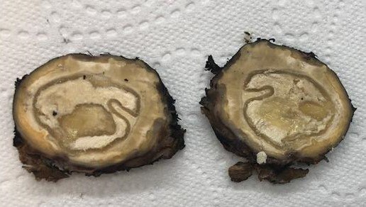 HLapsar's tweet photo. 48yo female, liver cyst. 
Pathology classics - ecchinococcal cyst
#liverpath #GIpath https://t.co/p8sllGM4UG