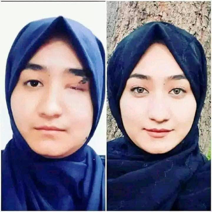ZabiullahAskari's tweet photo. قهرمان روشنایی! 

#StopHazaraGenocide https://t.co/Fm0cahRb12