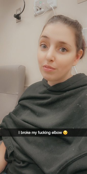 🤣 I legit broke my fucking elbow 🤣 https://t.co/vQm0rqhHm7