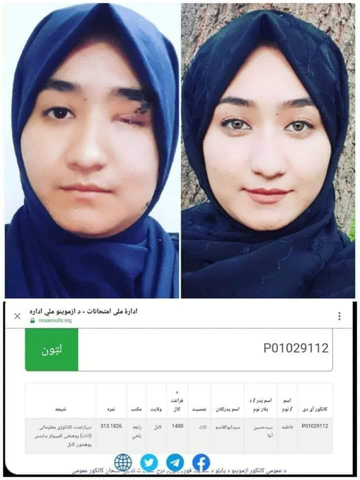 ShamsiaAlizada's tweet photo. زیبایی چشمهای تو سالهاست که جرم پنداشته میشود
تو میدانی که به سبب داشتن این چشم ها از ما سرهابریده و کله منار ها ساخته اند, گلو ها دریده, خون ها ریخته �� کشته اند.
اما تو هنوز چشم در چشم دشمن استوار و با ابهت ایستاده یی!

#StopHazaraGenocide 
#StopHazaraGenocide 
#کاج https://t.co/yaY22n7ohZ