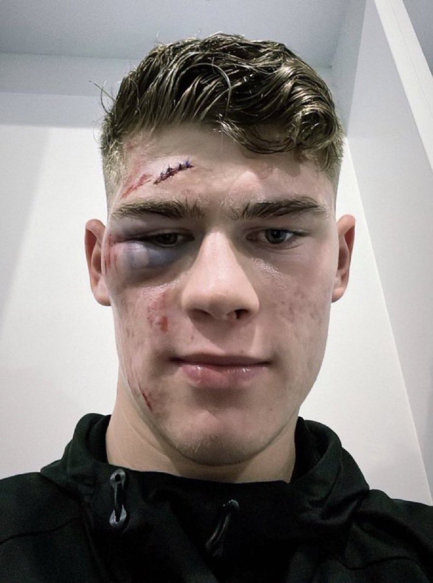 _The72's tweet photo. Millwall defender, Charlie Cresswell 😳 https://t.co/7fTVT7Tstj