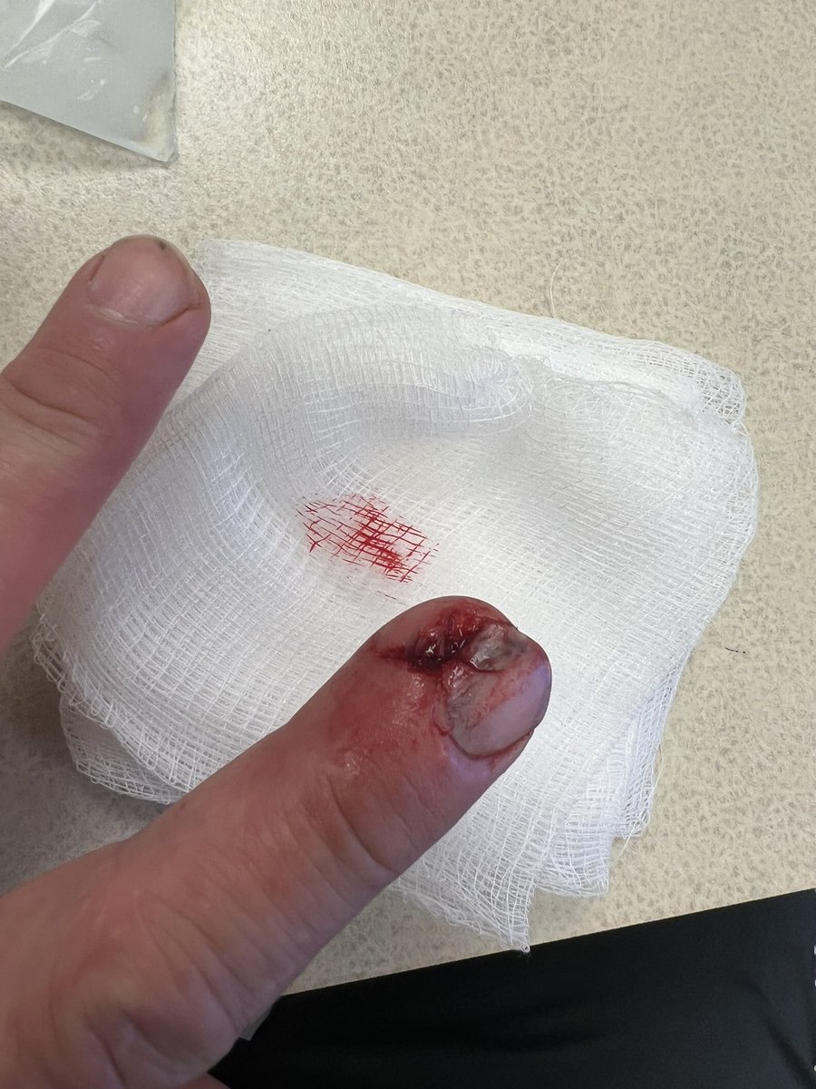 24_7Farnsworth's tweet image. Just a flesh wound! Hahaha. #montyPythonandtheholyGrail #idonthavetimetobleed
