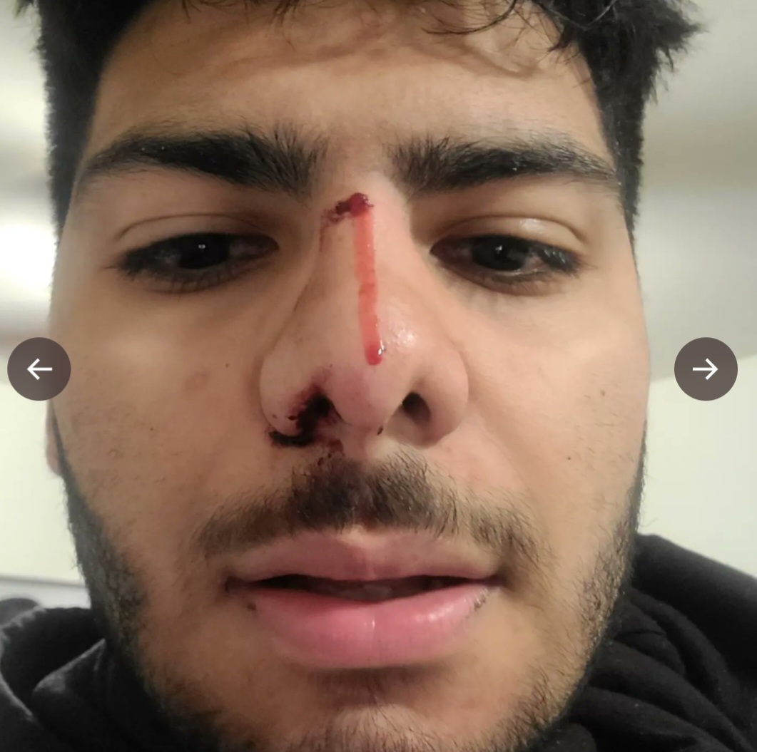 debbiepage13's tweet photo. @rriproarin @PostyCrew @PostMalone No harm done to Austin THIS TIME just an over eager fan but next one might not have the same good intentions. Dangerous situation. Security was too slow, anything could have happened. Scary  Afterwards they could have just thrown him out but... https://t.co/MwxuW4qaqQ
