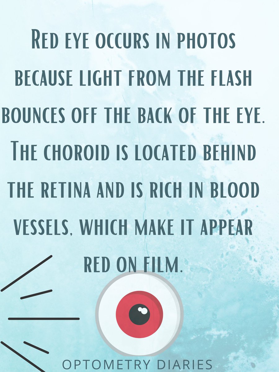 Optometry Diaries (@optometrydiari1) on Twitter photo 