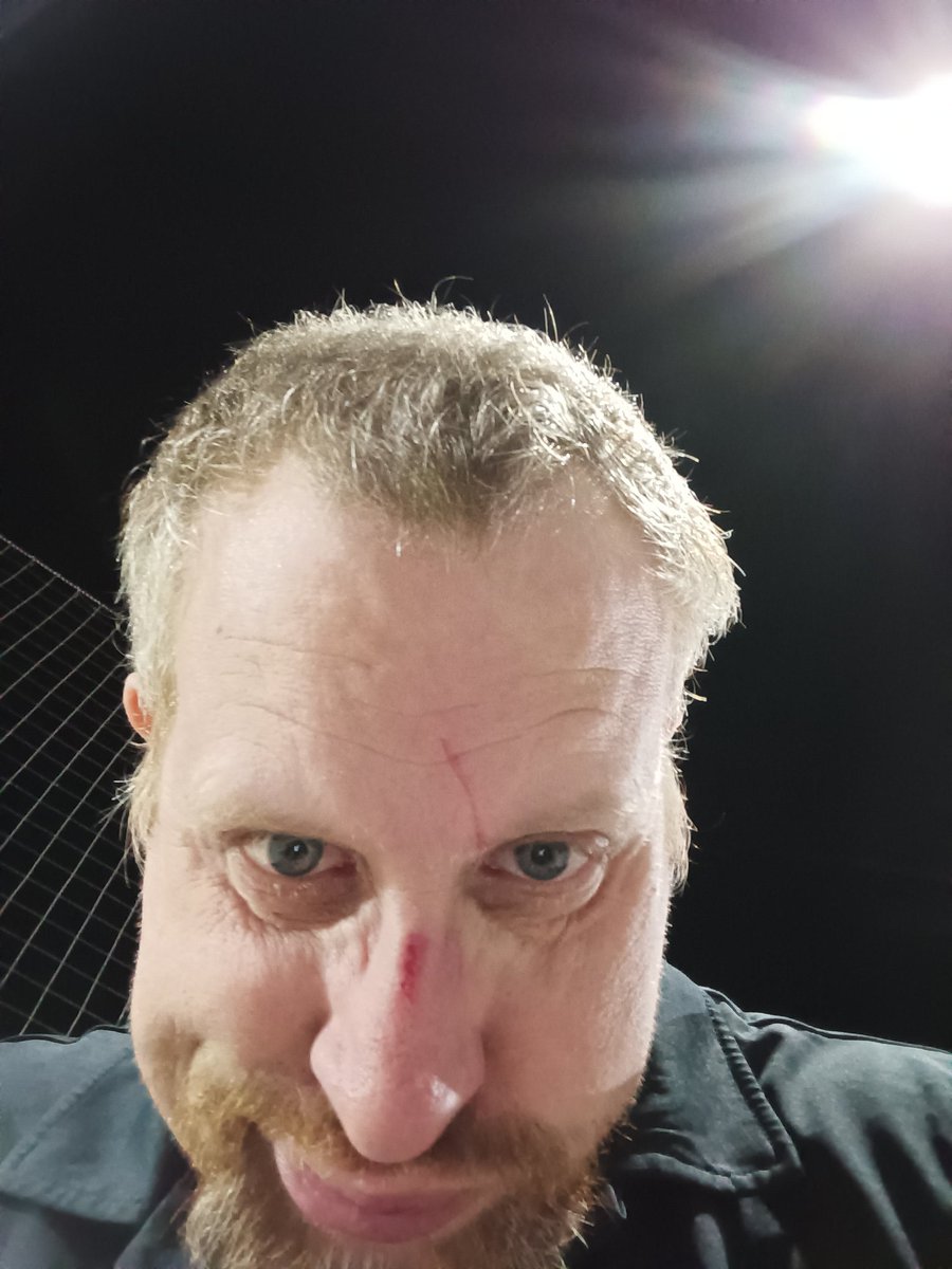 dmf7122's tweet photo. Smacked in the face with a volleyball on my birthday, broke my glasses but I had fun https://t.co/Nvg5SI3fTc