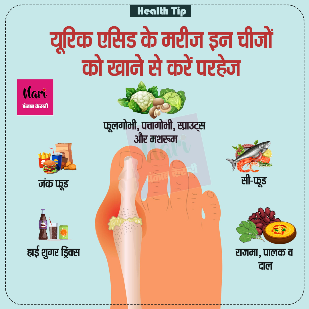 NariKesari's tweet photo. #healthtip
यूरिक एसिड के मरीज इन चीजों को खाने से करें परहेज
#healthcare #winterhealthcare #winterhealthtip #dryfruits #healthyfoodforwinter #winterseason #uricacid #uricaciddiet https://t.co/ilZj8jjsTk