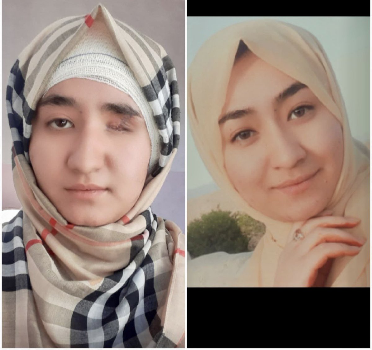 TheAliMD's tweet photo. فاطمه، اگر هزاره نبودی، با چنین سرنوشتی روبرو نمی‌شد. فاطمه اگر هزاره نبودی، پس از حمله و موفقیت در کانکور، می‌شد «ملاله یوسف‌زی».

#StopHazaraGenocide https://t.co/QSdKeQ5dJz